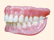 超精密（BPS）入れ歯・義歯